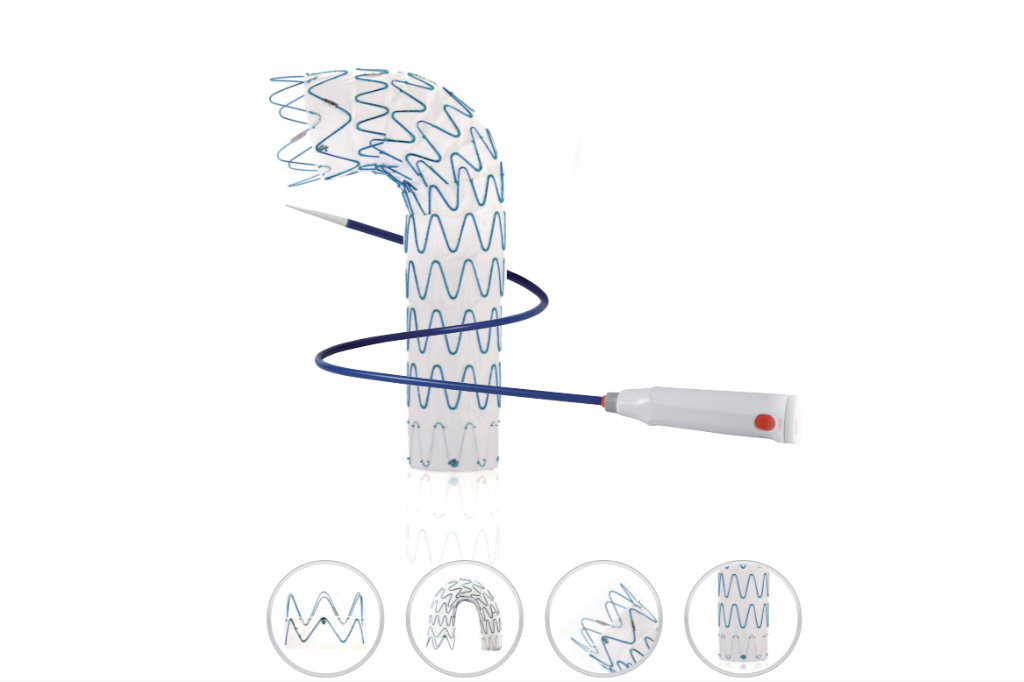 Thoracic Aortic Stent Graft Systems: Which One Is Reliable?